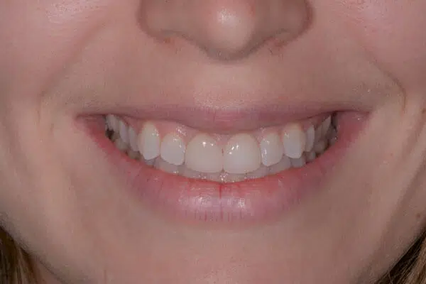 close up on woman's smiling mouth