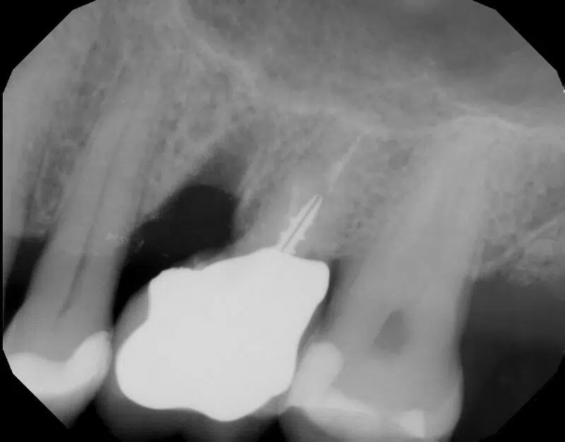close up of dental x-ray